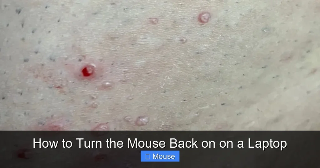 How to Turn the Mouse Back on on a Laptop