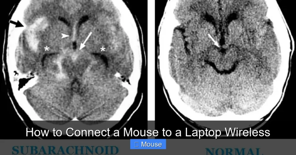 How to Connect a Mouse to a Laptop Wireless