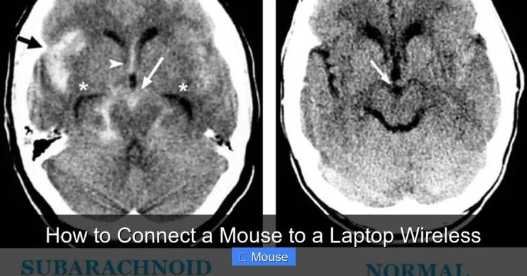 How to Connect a Mouse to a Laptop Wireless